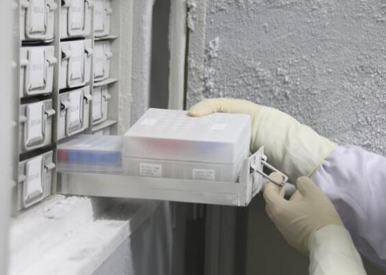 微生物菌種保存方法--80℃冰箱凍結法